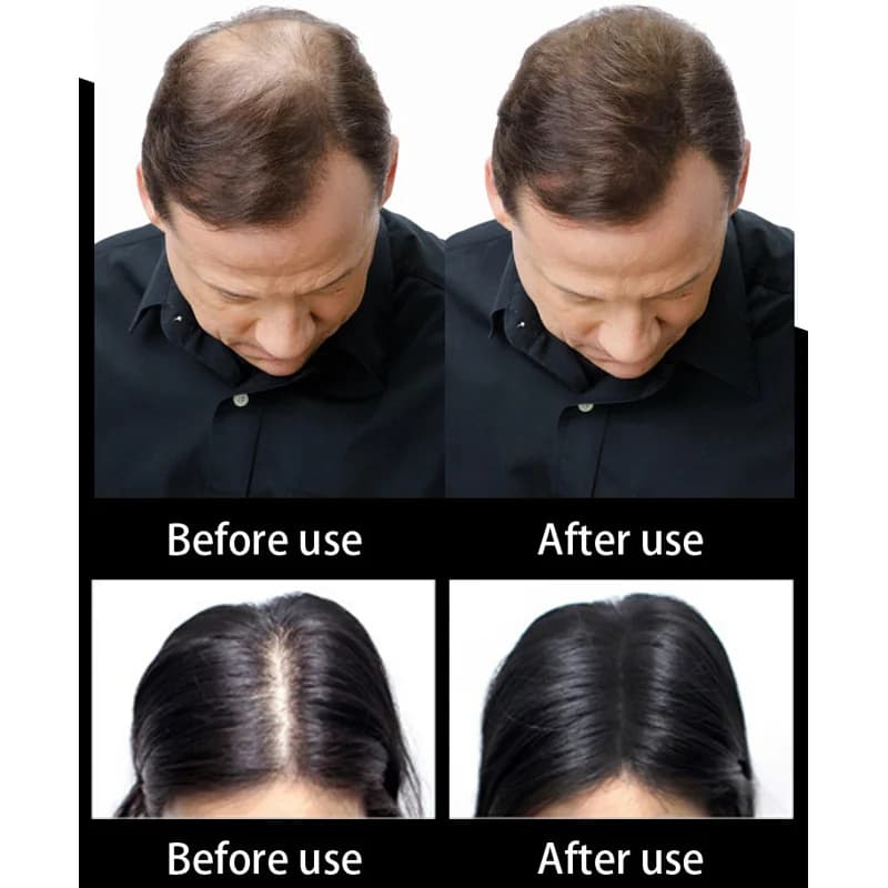 SEVICH – Fiber de cheveux à la kératine, 500g, traitement de perte de cheveux humains, soins de coul