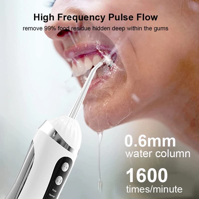 Irrigateur buccal électrique, hydropulseur Portable, nettoyage dentaire domestique, Rechargeable, ét