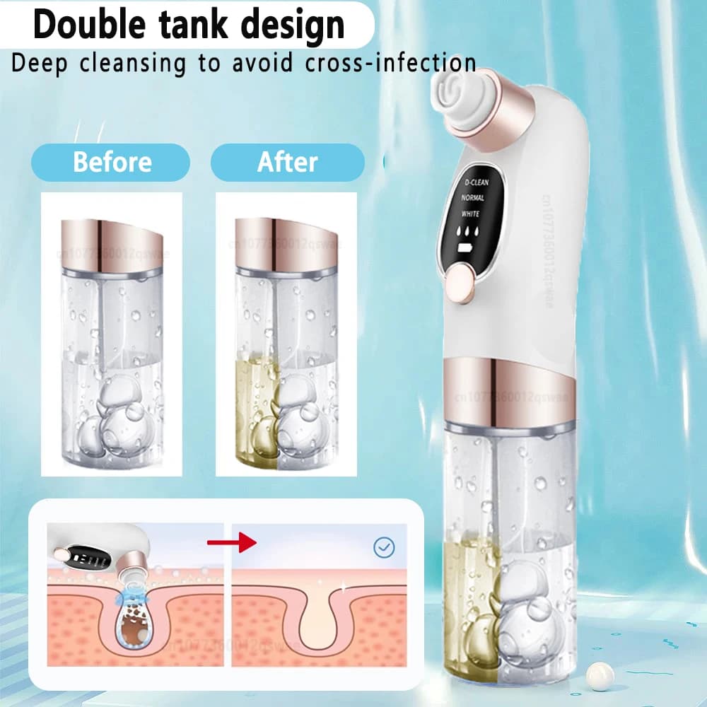 Extracteur de points noirs et nettoyeur de pores électrique pour le visage, anti-acné, rechargeable 