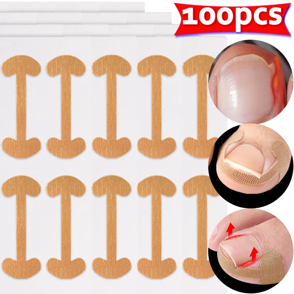 Bandes correctrices pour ongles incarnés, 100 pièces, adhérence durable, autocollants imperméables, 