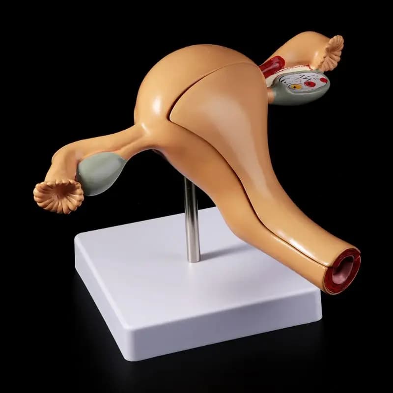 Accessoires médicaux, modèle d'ovaire d'utérus pathologique humain, anatomie de la maladie, lésion m