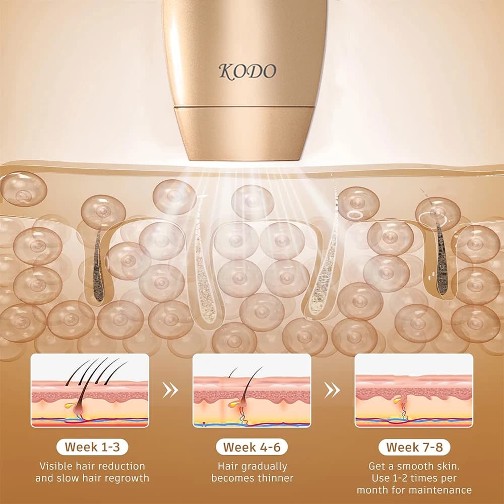 KODO 2026 Épilateur laser à glace haut de gamme personnalisable, épilation permanente IPL indolore, 