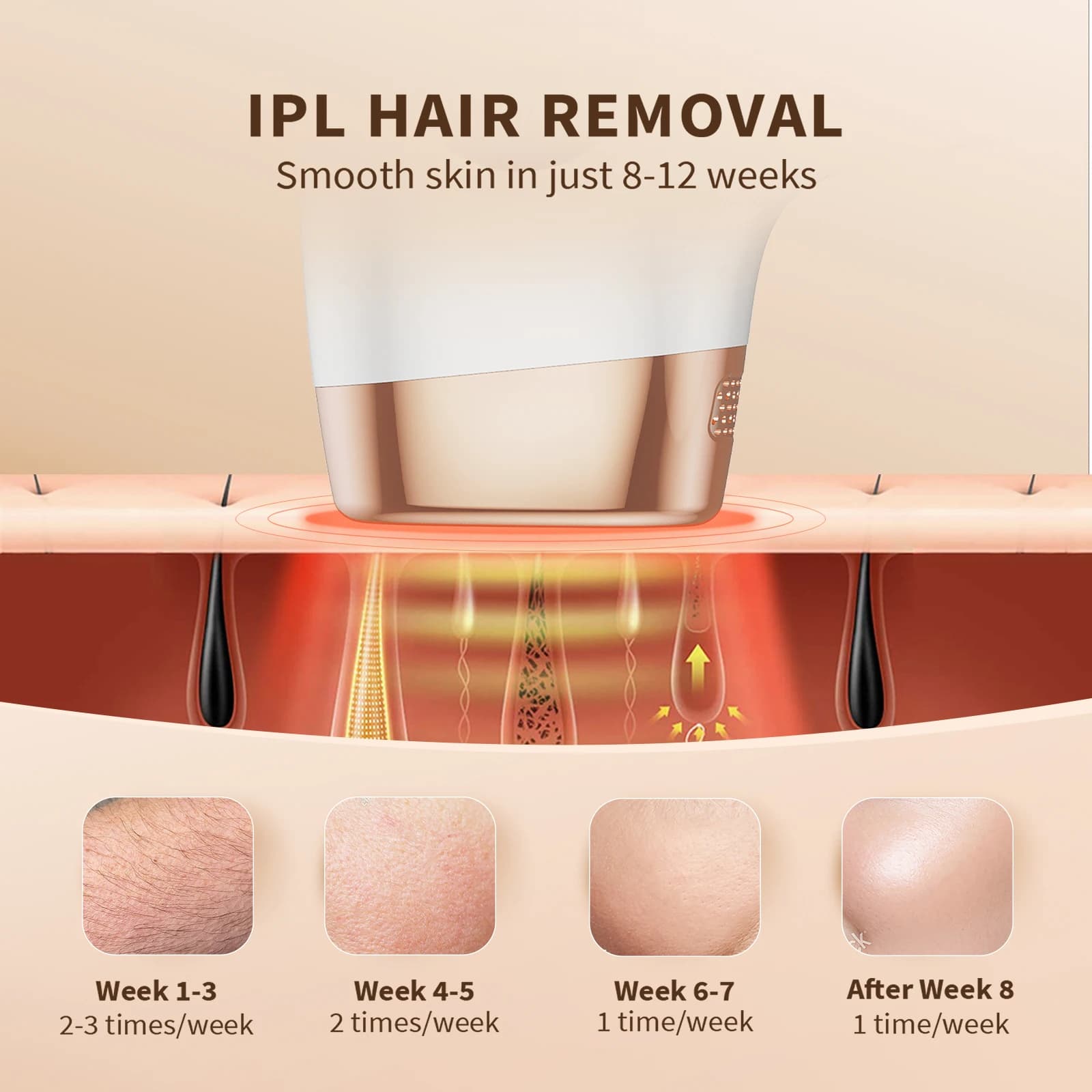 Appareil d'épilation au laser indolore pour hommes et femmes, épilateur à lumière pulsée IPL, épilat