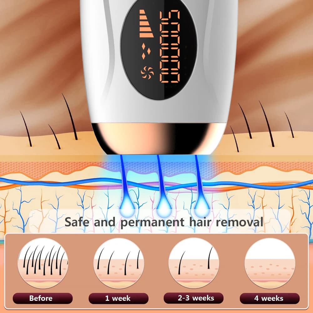 Depilador a laser ipl, remoção de pelos para mulheres, biquíni corporal, facial, 990000 flashes, per