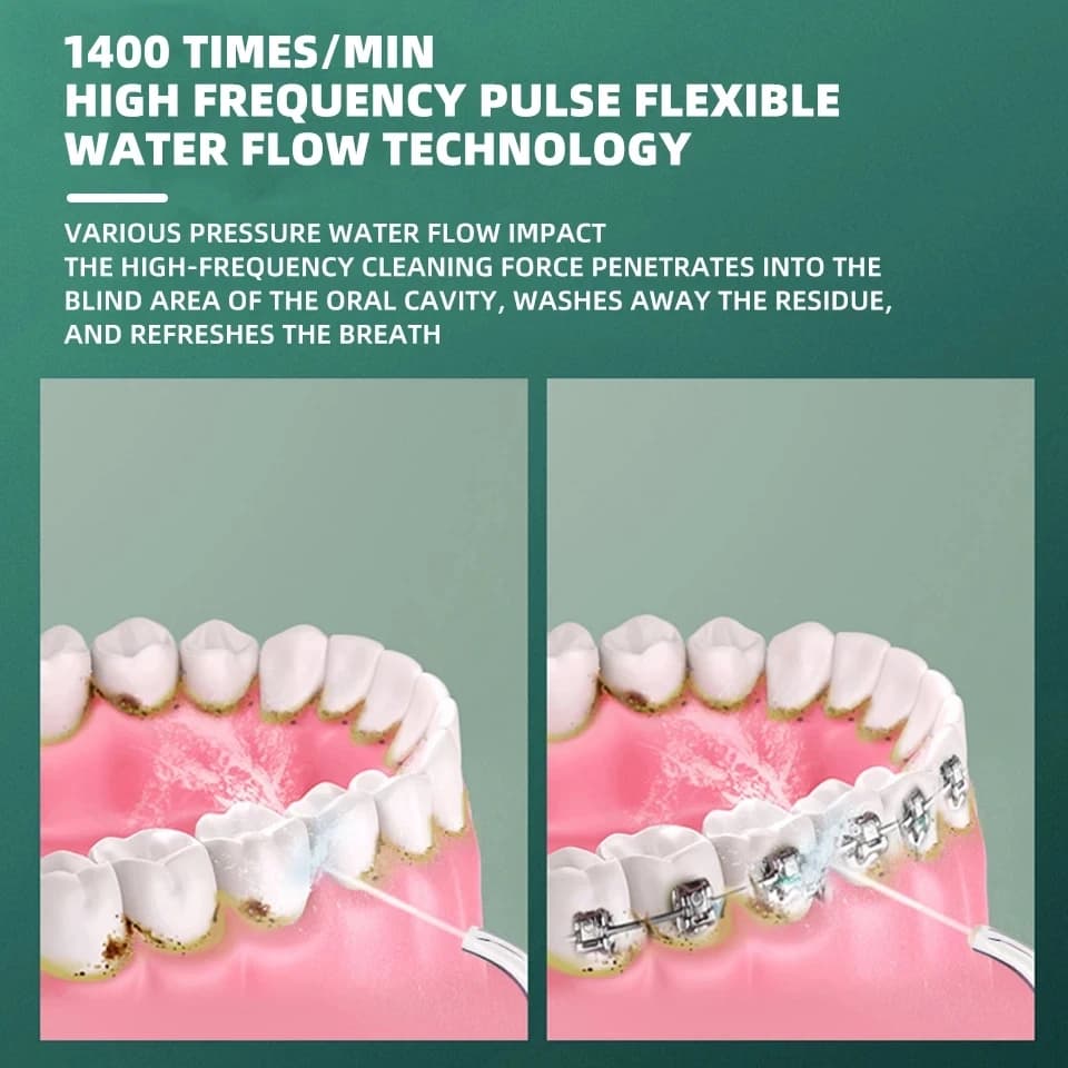 Xiaomi nettoyeur de dents électrique irrigateur Oral Rechargeable Jet d'eau nettoyeur de dents blanc