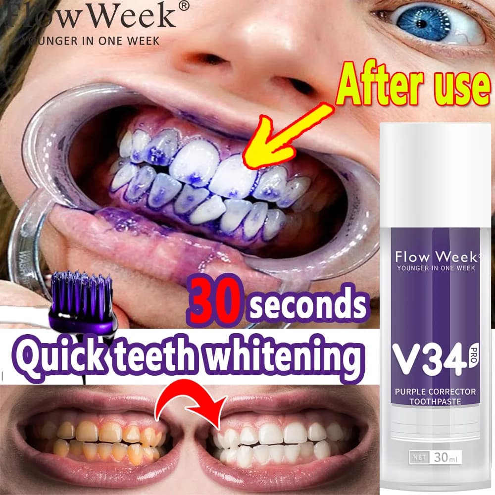 Flow-du-- Dentifrice orthodontique V34 Pro, Protection des dents, Soin de l'émail dentaire, Décontam