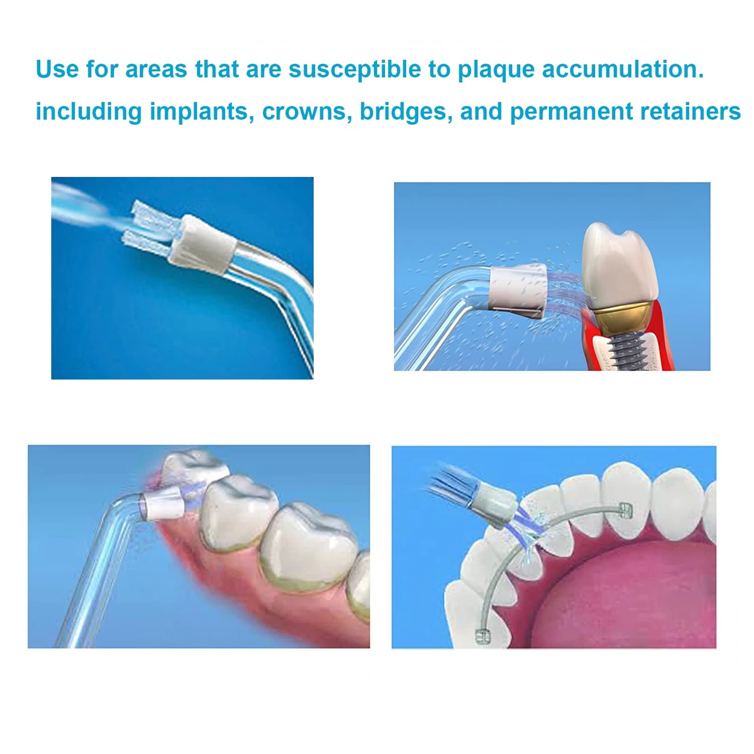 Embout de recherche de Plaque pour remplacement de fil dentaire Waterpik et autre marque d'irrigateu