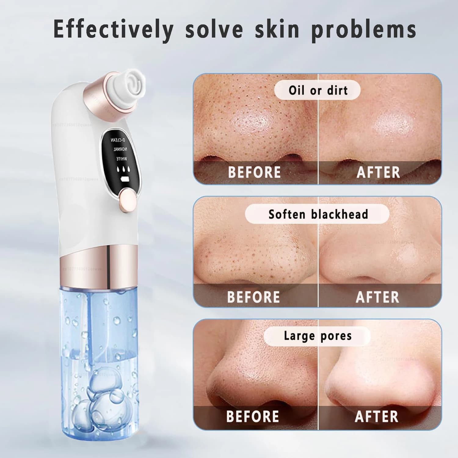 Extracteur de points noirs et nettoyeur de pores électrique pour le visage, anti-acné, rechargeable 