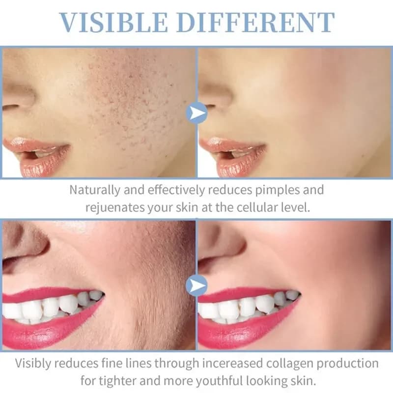 4 en 1 électrique portatif pour le visage outils de beauté de la peau Portable haute fréquence bague