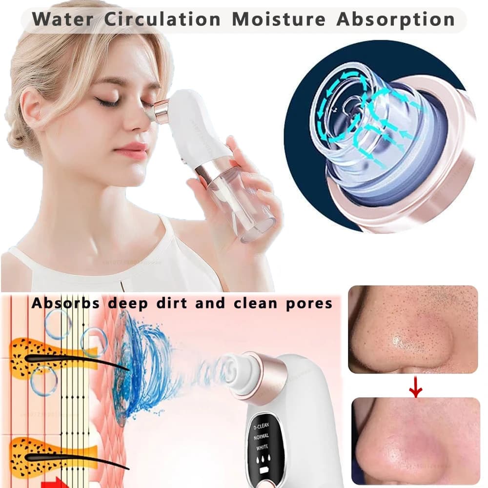 Extracteur de points noirs et nettoyeur de pores électrique pour le visage, anti-acné, rechargeable 