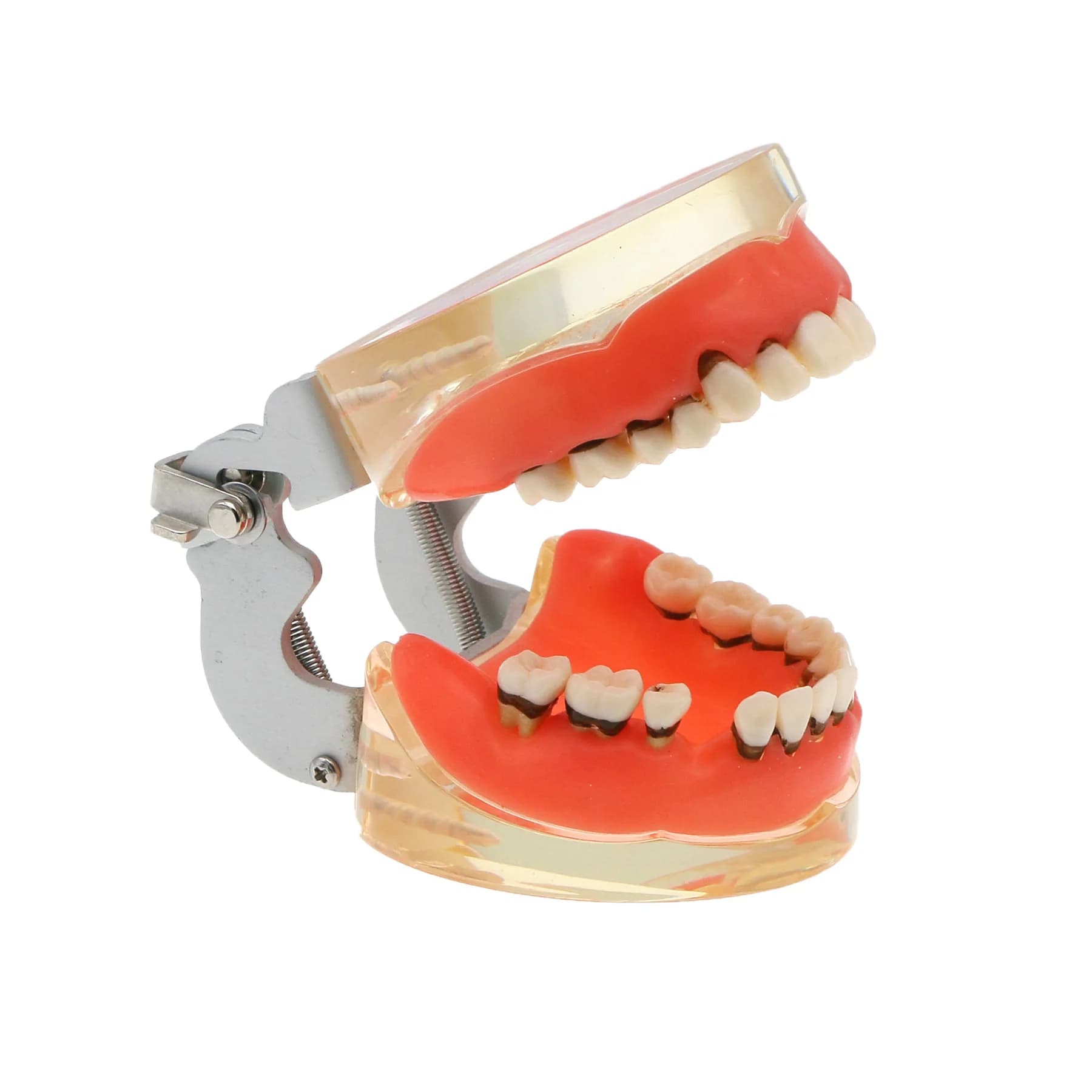 Modèle de dents dentaires, modèle d'enseignement de dentiste, démonstration de maladies parodontales